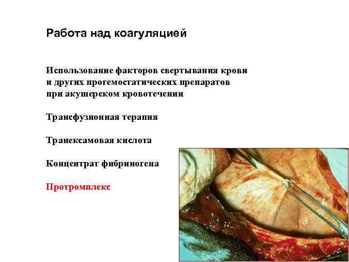 Работа над коагуляцией Использование факторов свертывания крови и других прогемостатических препаратов при акушерском кровотечении