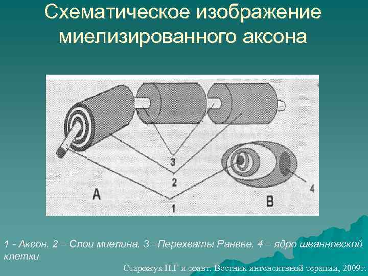 Схематическое изображение миелизированного аксона 1 - Аксон. 2 – Слои миелина. 3 –Перехваты Ранвье.