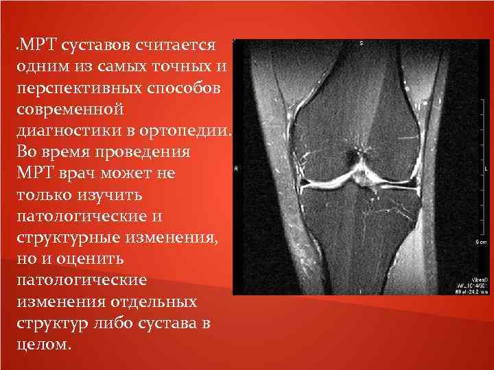 МРТ суставов считается одним из самых точных и перспективных способов современной диагностики в ортопедии.