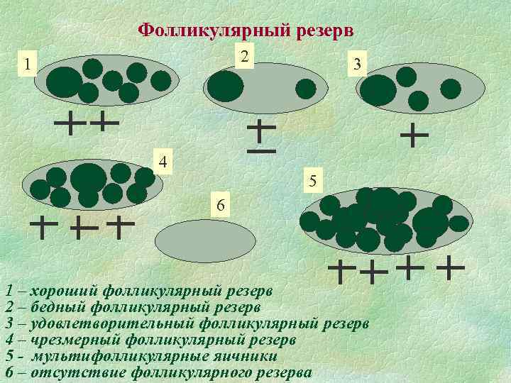Фолликулярный резерв 2 1 3 4 5 6 1 – хороший фолликулярный резерв 2