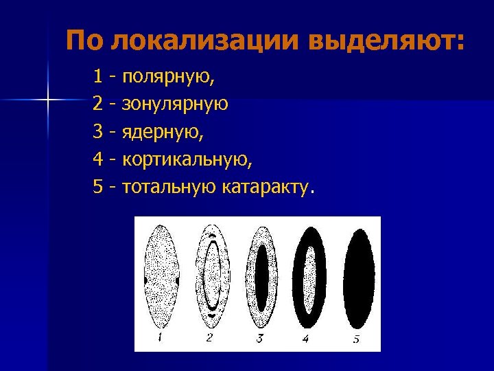 По локализации выделяют: 1 - полярную, 2 - зонулярную 3 - ядерную, 4 -