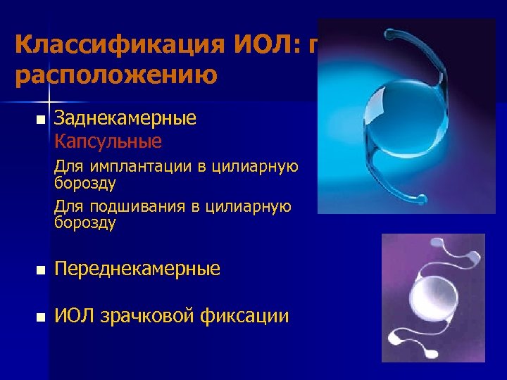 Классификация ИОЛ: по расположению n Заднекамерные Капсульные Для имплантации в цилиарную борозду Для подшивания