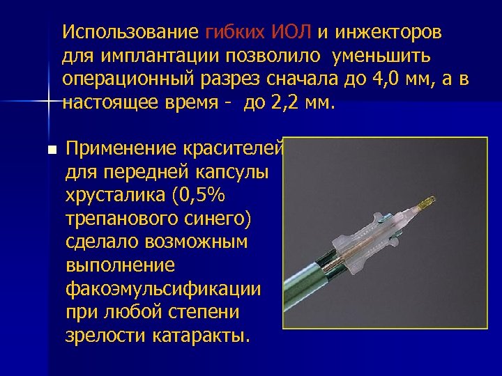 Использование гибких ИОЛ и инжекторов для имплантации позволило уменьшить операционный разрез сначала до 4,