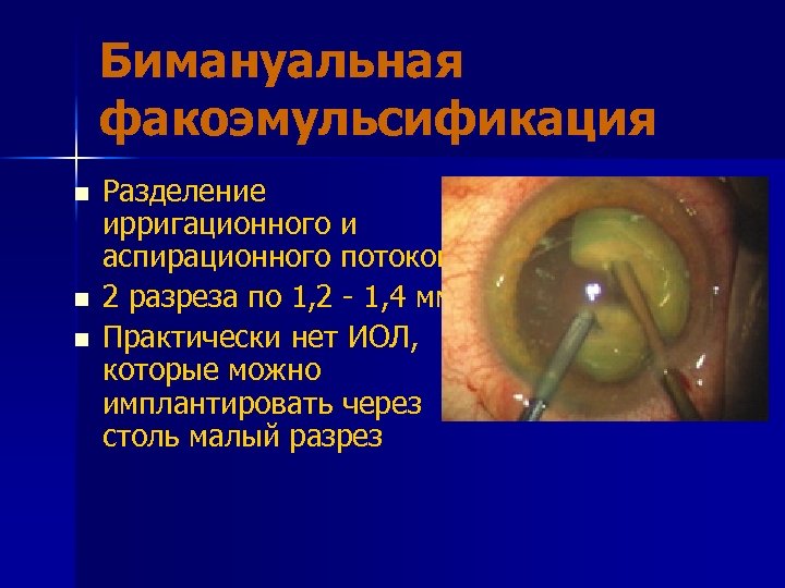 Бимануальная факоэмульсификация n n n Разделение ирригационного и аспирационного потоков 2 разреза по 1,