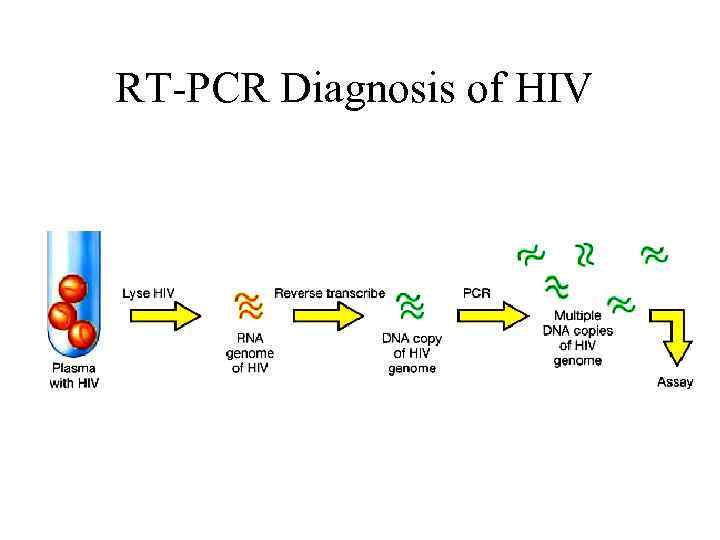 RT-PCR Diagnosis of HIV 