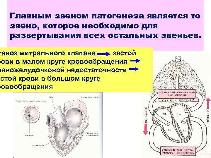 Главным звеном патогенеза является то звено, которое необходимо для развертывания всех остальных звеньев. теноз