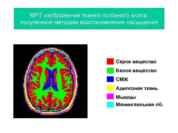 МРТ изображение тканей головного мозга, полученное методом восстановления насыщения Серое вещество Белое вещество СМЖ