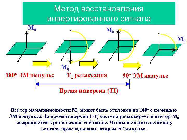Метод восстановления инвертированного сигнала M 0 M 0 y x 180 o ЭМ импульс