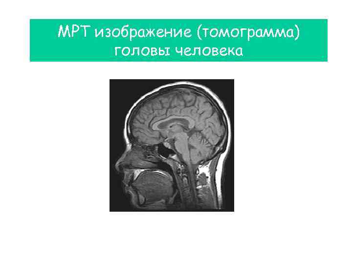 МРТ изображение (томограмма) головы человека 