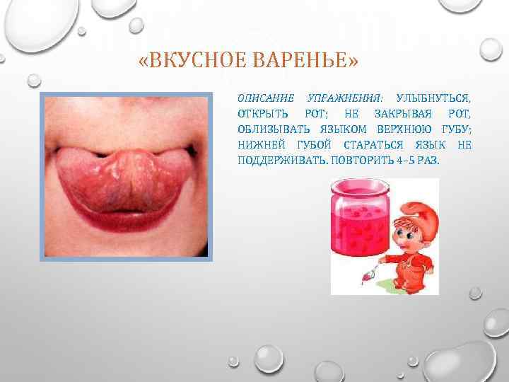  «ВКУСНОЕ ВАРЕНЬЕ» ОПИСАНИЕ УПРАЖНЕНИЯ: УЛЫБНУТЬСЯ, ОТКРЫТЬ РОТ; НЕ ЗАКРЫВАЯ РОТ, ОБЛИЗЫВАТЬ ЯЗЫКОМ ВЕРХНЮЮ