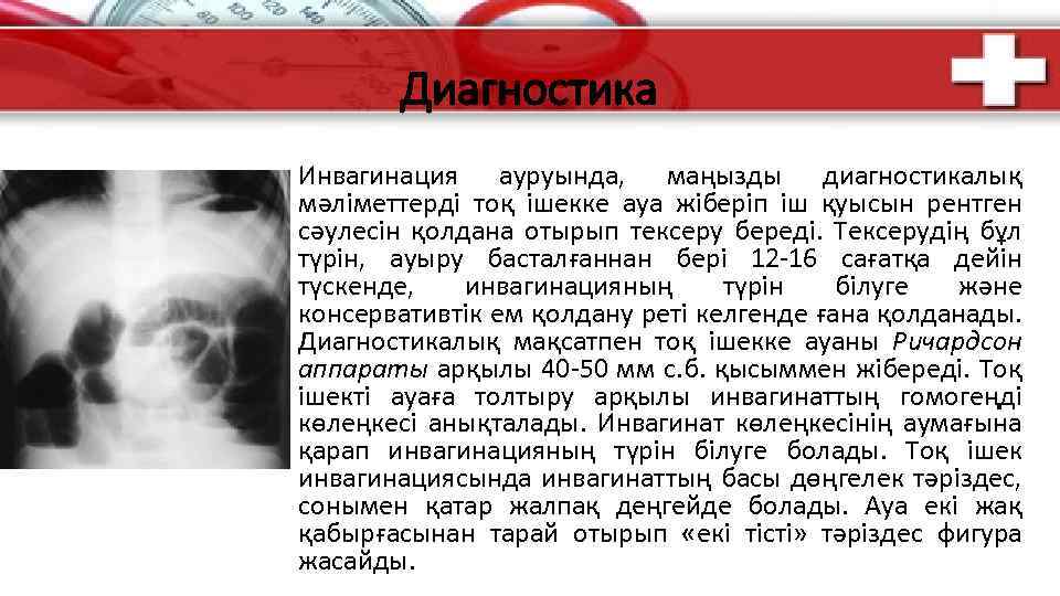 Диагностика Инвагинация ауруында, маңызды диагностикалық мәліметтерді тоқ ішекке ауа жіберіп іш қуысын рентген сәулесін