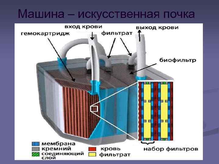 Схема искусственной почки