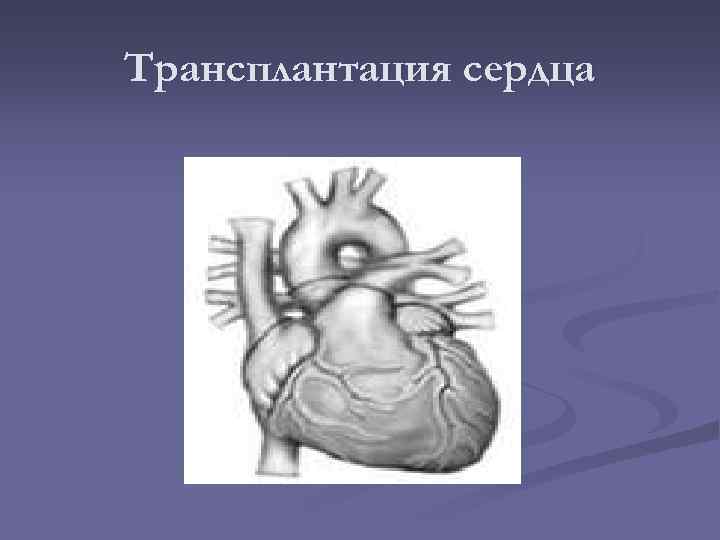 Трансплантация сердца 