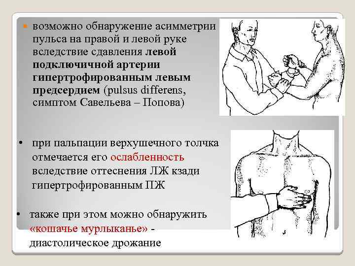 Как измерить пульс на руке. Пальпация подключичной артерии. Пальпация пульса на плечевой артерии. Пульс на подключичной артерии. Сдавление подключичной артерии.