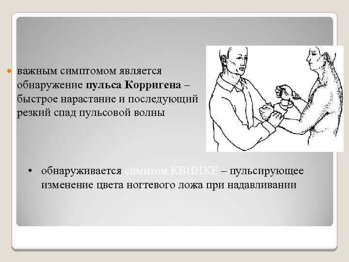  важным симптомом является обнаружение пульса Корригена – быстрое нарастание и последующий резкий спад