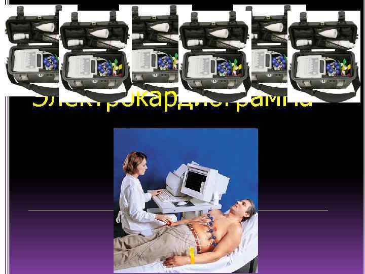 Электрокардиограмма 