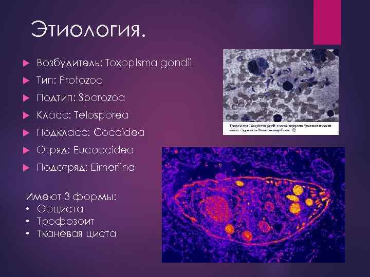 Этиология. Возбудитель: Toxoplsma gondii Тип: Protozoa Подтип: Sporozoa Класс: Тelosporea Подкласс: Coccidea Отряд: Eucoccidea
