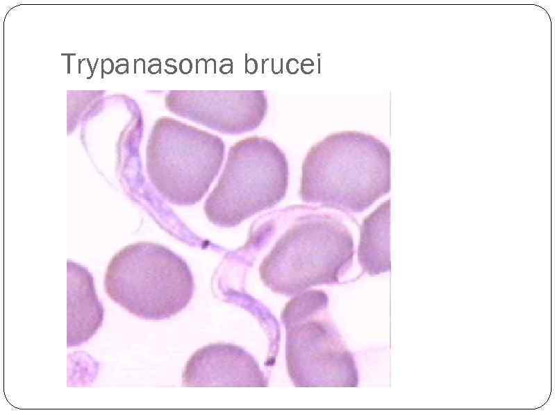 Trypanasoma brucei 