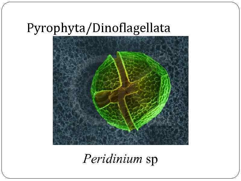 Pyrophyta/Dinoflagellata Peridinium sp 