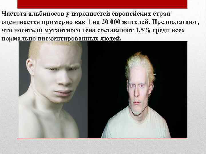 Частота альбиносов у народностей европейских стран оценивается примерно как 1 на 20 000 жителей.