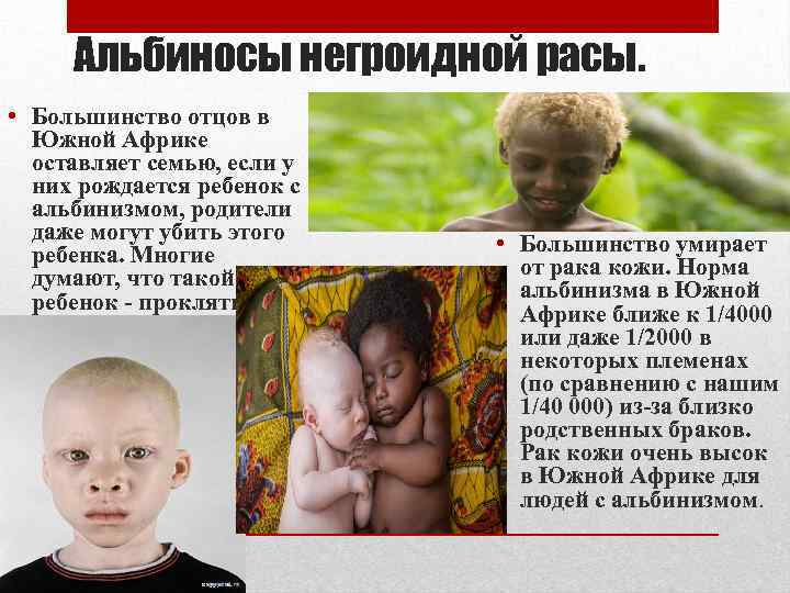 Альбиносы негроидной расы. • Большинство отцов в Южной Африке оставляет семью, если у них