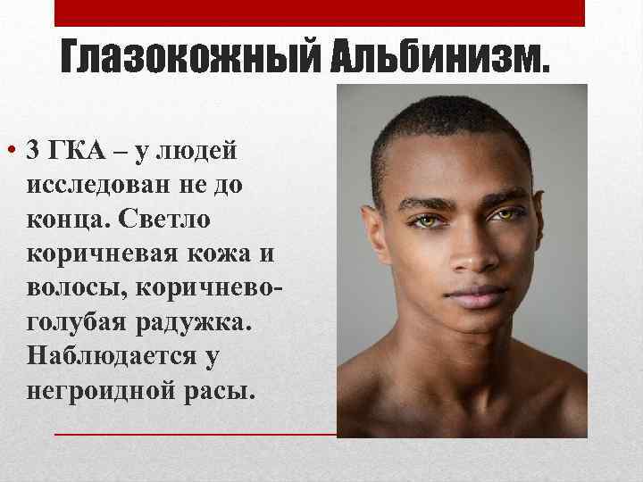 Глазокожный Альбинизм. • 3 ГКА – у людей исследован не до конца. Светло коричневая