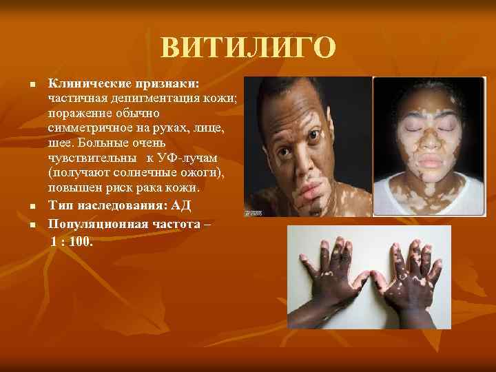 ВИТИЛИГО n n n Клинические признаки: частичная депигментация кожи; поражение обычно симметричное на руках,
