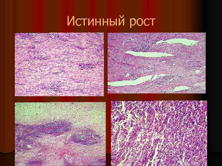 Истинный рост 