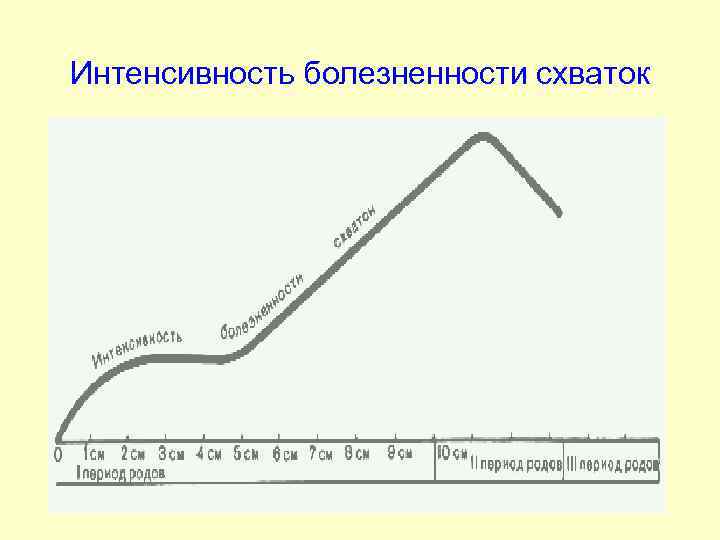 Интенсивность болезненности схваток 