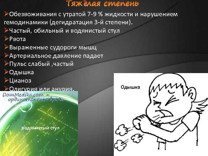 ØОбезвоживания с утратой 7 -9 % жидкости и нарушением гемодинамики (дегидратация 3 -й степени).