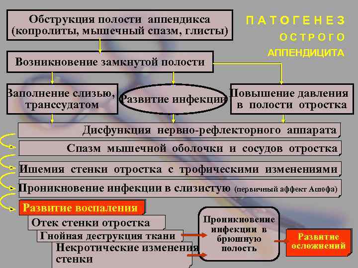 Обструкция полости аппендикса (копролиты, мышечный спазм, глисты) Возникновение замкнутой полости ПАТОГЕНЕЗ ОСТРОГО АППЕНДИЦИТА Заполнение