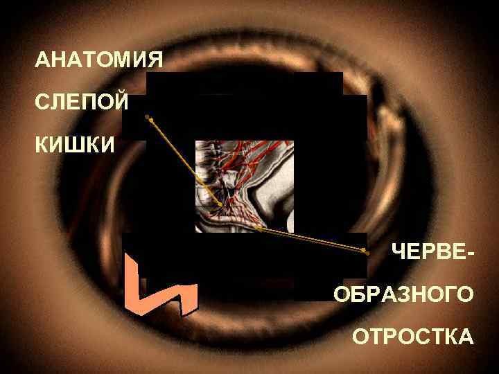 АНАТОМИЯ СЛЕПОЙ КИШКИ ЧЕРВЕОБРАЗНОГО ОТРОСТКА 