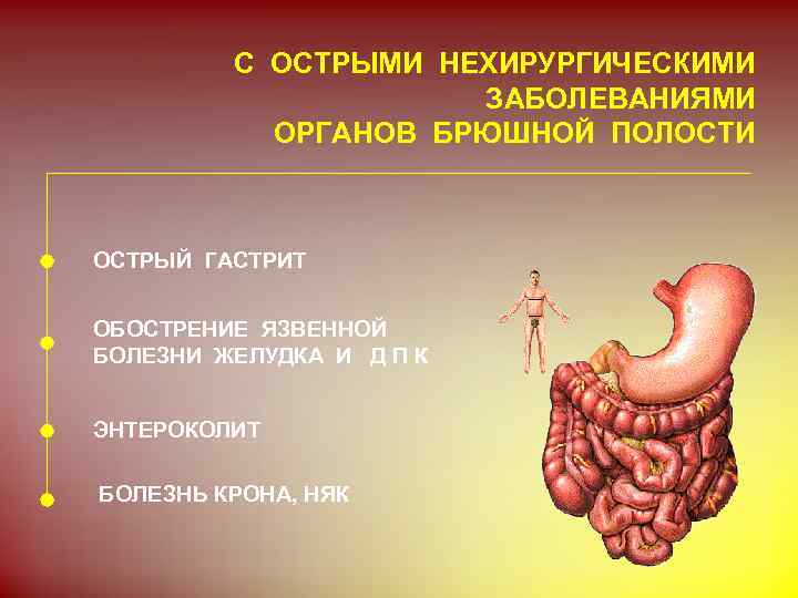 С ОСТРЫМИ НЕХИРУРГИЧЕСКИМИ ЗАБОЛЕВАНИЯМИ ОРГАНОВ БРЮШНОЙ ПОЛОСТИ ОСТРЫЙ ГАСТРИТ ОБОСТРЕНИЕ ЯЗВЕННОЙ БОЛЕЗНИ ЖЕЛУДКА И