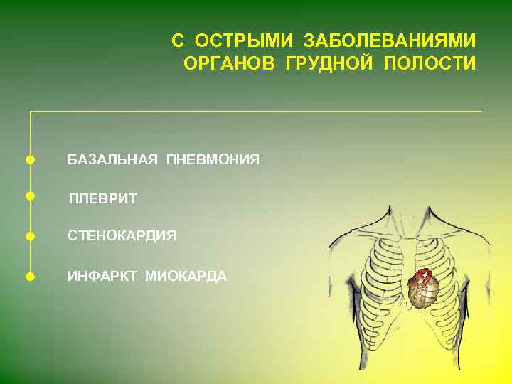 С ОСТРЫМИ ЗАБОЛЕВАНИЯМИ ОРГАНОВ ГРУДНОЙ ПОЛОСТИ БАЗАЛЬНАЯ ПНЕВМОНИЯ ПЛЕВРИТ СТЕНОКАРДИЯ ИНФАРКТ МИОКАРДА 