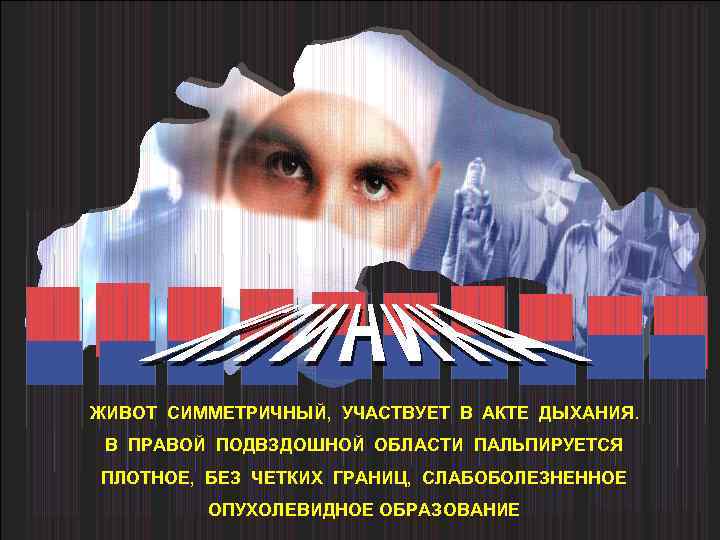 ЖИВОТ СИММЕТРИЧНЫЙ, УЧАСТВУЕТ В АКТЕ ДЫХАНИЯ. В ПРАВОЙ ПОДВЗДОШНОЙ ОБЛАСТИ ПАЛЬПИРУЕТСЯ ПЛОТНОЕ, БЕЗ ЧЕТКИХ