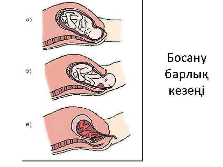 Босану барлық кезеңі 