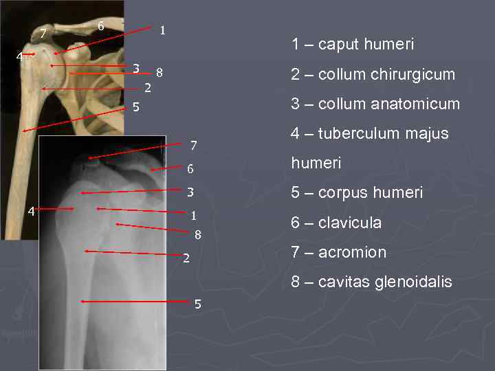 7 4 6 1 3 1 – caput humeri 8 2 – collum chirurgicum