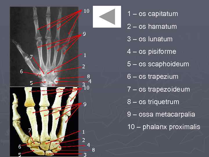 10 1 – os capitatum 2 – os hamatum 9 7 3 – os