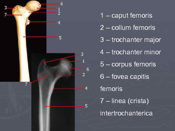 6 3 1 2 7 1 – caput femoris 4 2 – collum femoris