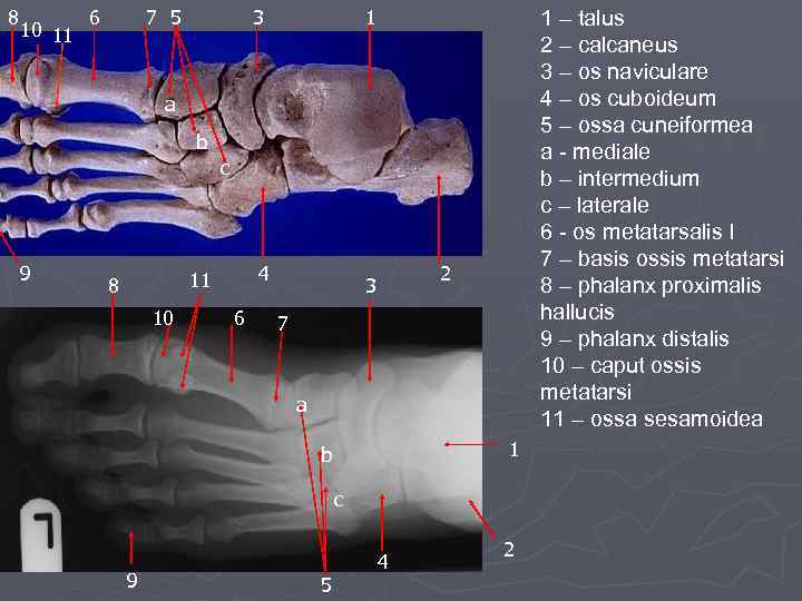 8 10 11 6 7 5 3 1 1 – talus 2 – calcaneus