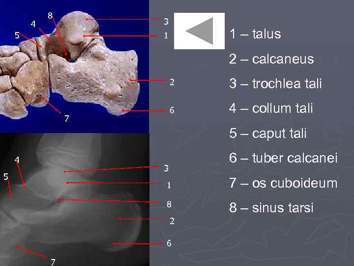 4 8 3 5 1 – talus 1 2 – calcaneus 2 6 7