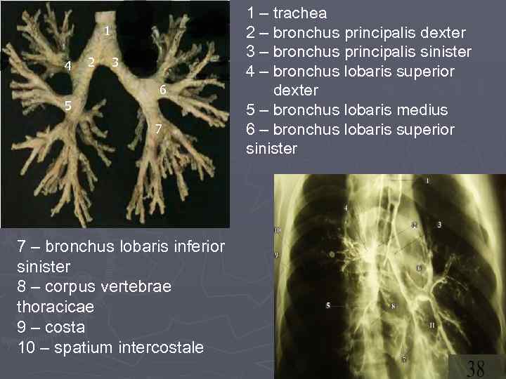 1 4 2 3 6 5 7 7 – bronchus lobaris inferior sinister 8