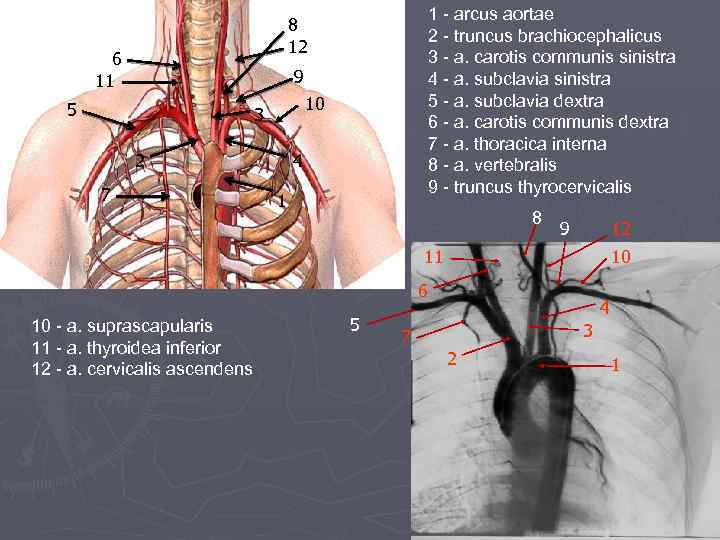 1 - arcus aortae 2 - truncus brachiocephalicus 3 - a. carotis communis sinistra