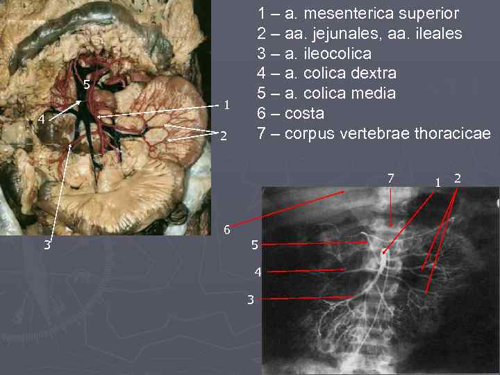 1 – a. mesenterica superior 2 – aa. jejunales, aa. ileales 3 – a.