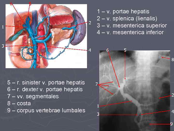 6 5 2 1 3 1 – v. portae hepatis 2 – v. splenica