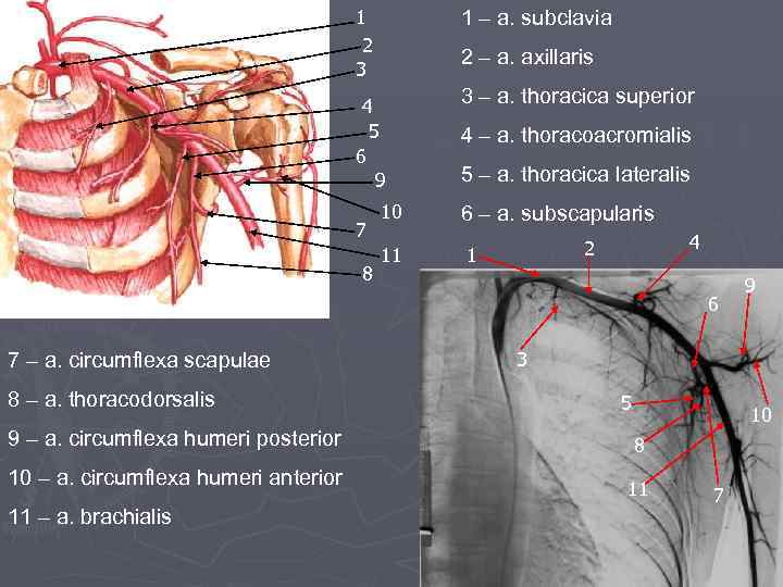 1 2 3 1 – a. subclavia 2 – a. axillaris 4 5 6