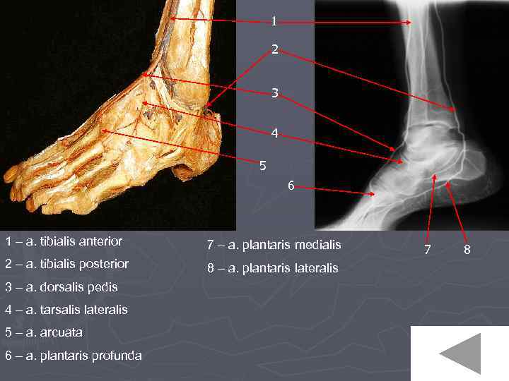 1 2 3 4 5 6 1 – a. tibialis anterior 7 – a.