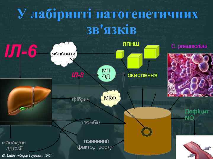 У лабіринті патогенетичних зв'язків ІЛ-6 ЛПНЩ C. pneumoniae моноцити ІЛ-8 фібрин МП ОД МКФ