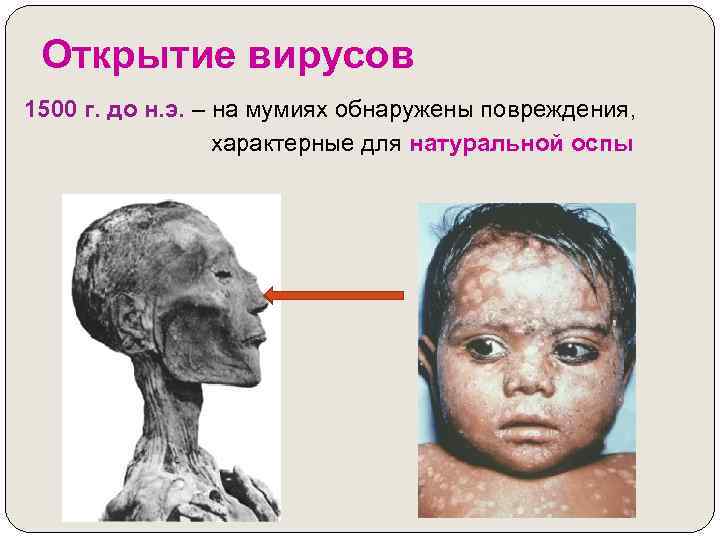 Открытие вирусов 1500 г. до н. э. – на мумиях обнаружены повреждения, характерные для