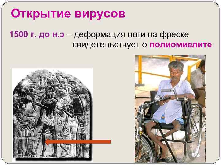 Открытие вирусов 1500 г. до н. э – деформация ноги на фреске свидетельствует о